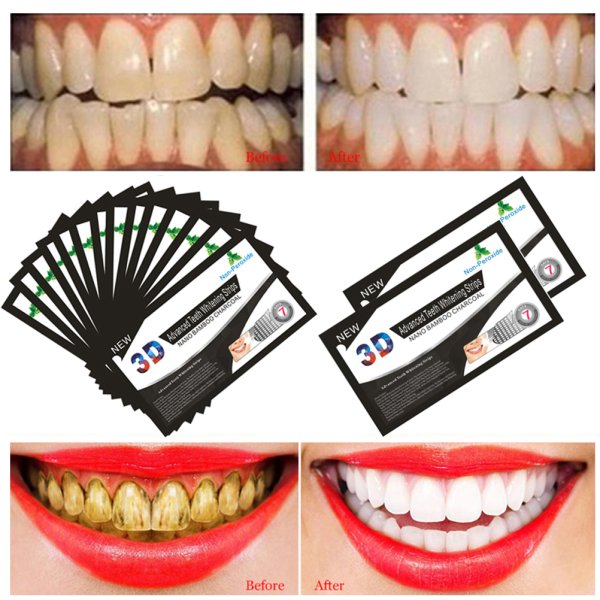 Наклейки на зубы одноразовые