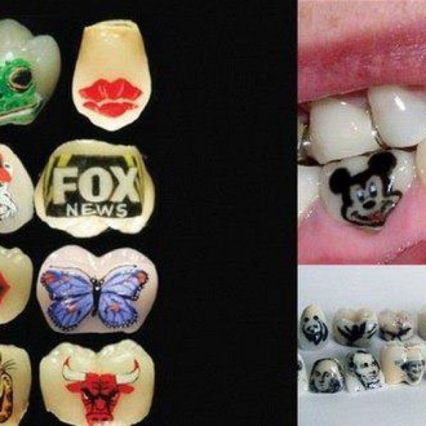 Здоровые зубы