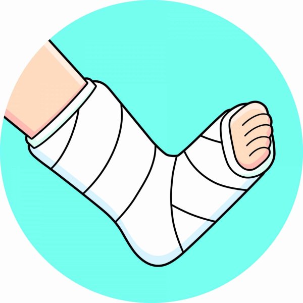 Гипс значок