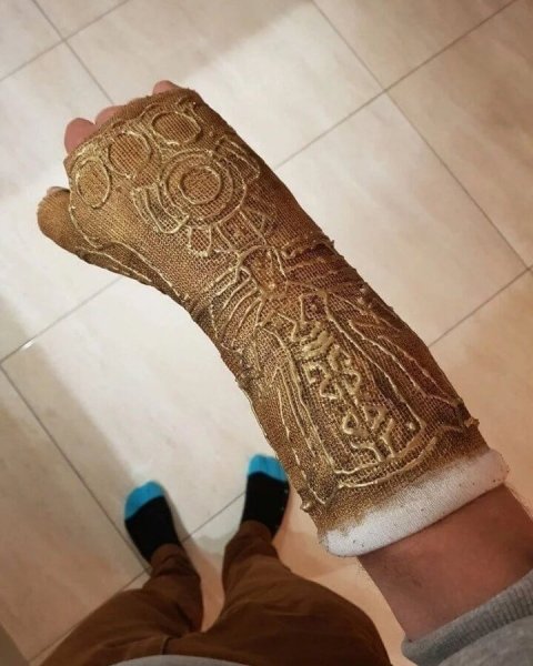 Разукрашенный гипс на руке