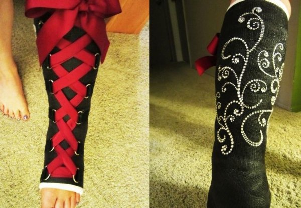 Разрисованный гипс