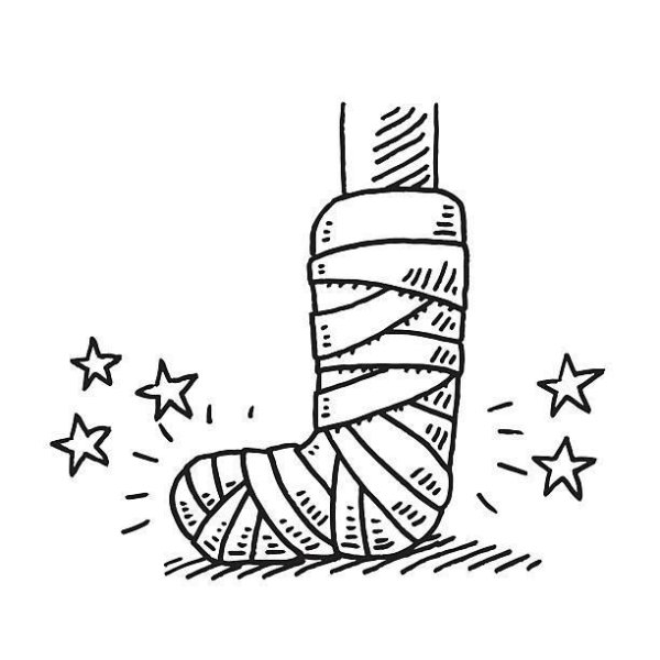 Гипс на ноге иллюстрация