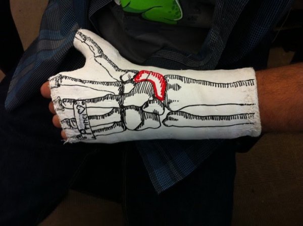 Разрисованный гипс