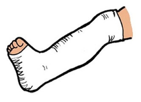 Разрисованный гипс