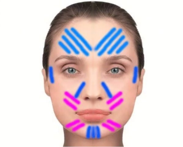 Тейпирование межбровной складки