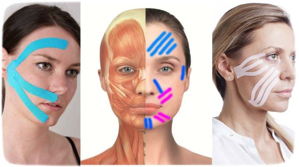 Кензо тейпирование лица