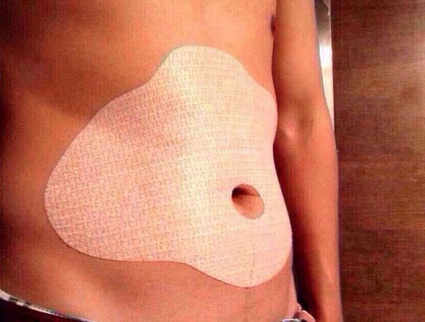 Пластырь на животе