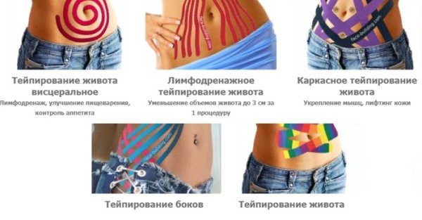 Схемы тейпирования для похудения живота и боков