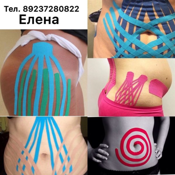 Тейпирование живота для похудения схема