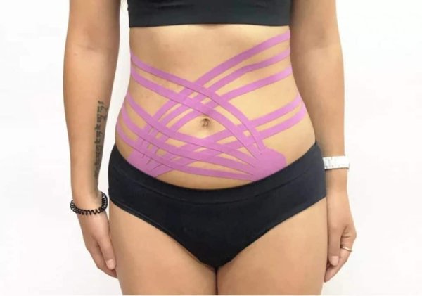 Тейпирование для похудения живота и боков