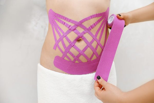 Тейпирование для похудения живота и боков