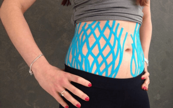 Тейпы от фартука на животе