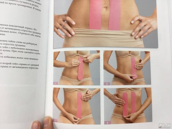 Схемы тейпирования для похудения живота и боков