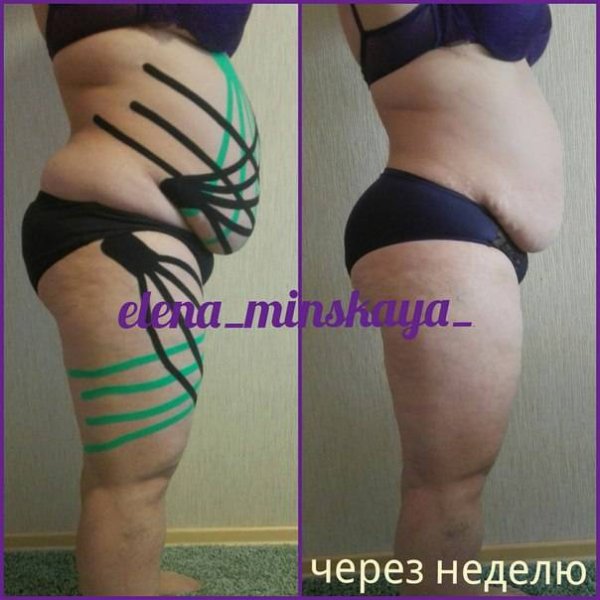 Похудение значок