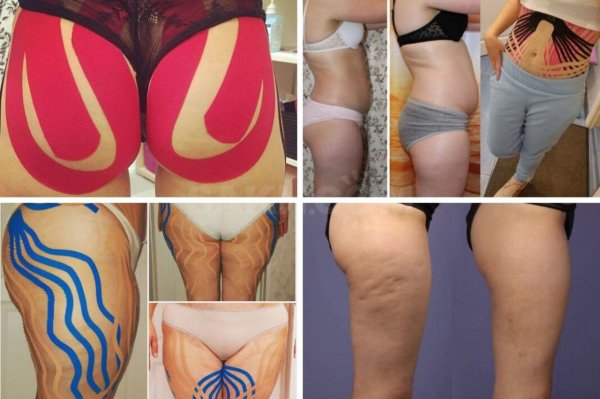 День живота