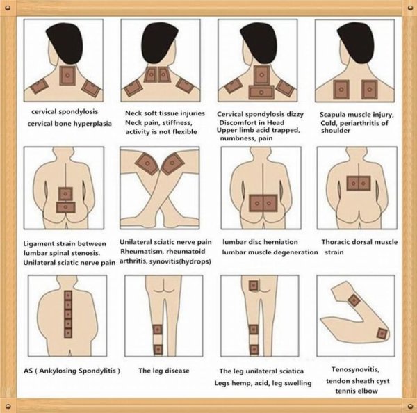 Кашель с отхождением мокроты