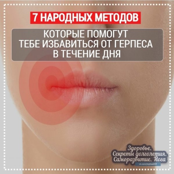 Противовирусные от герпеса на губах