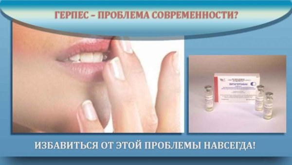 Стадии развития герпеса на губах