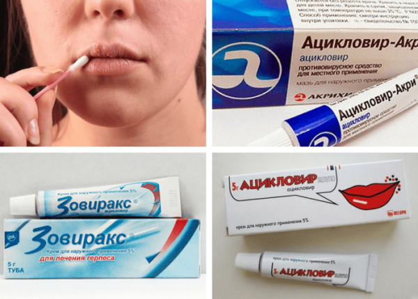 Герпес начальная стадия