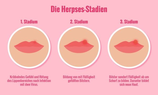 Фенистил Пенцивир мазь