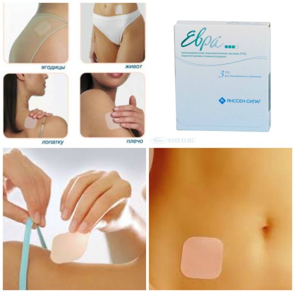 Трансдермальная контрацептивная система евра