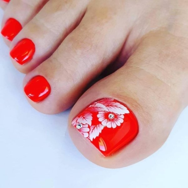 Пластырь для коррекции вросшего ногтя