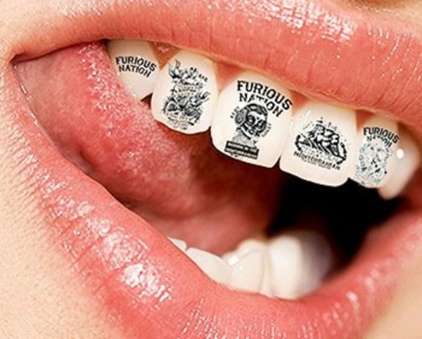 Детские брекеты цветные