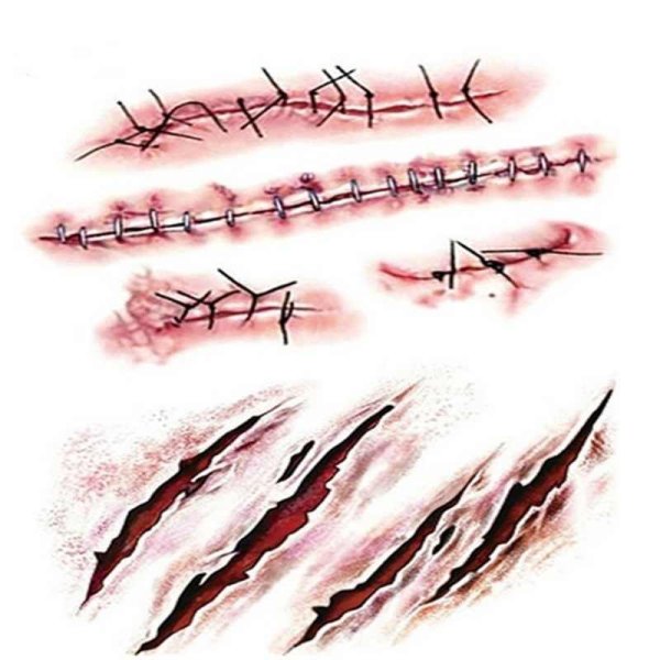 Следы когтей