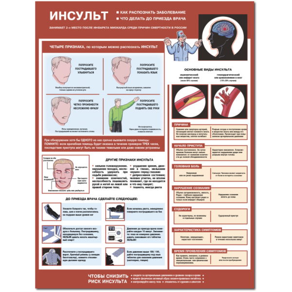 Медицинские плакаты инсульт
