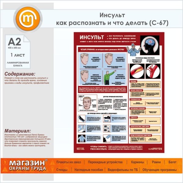 Топический плакат неврологии