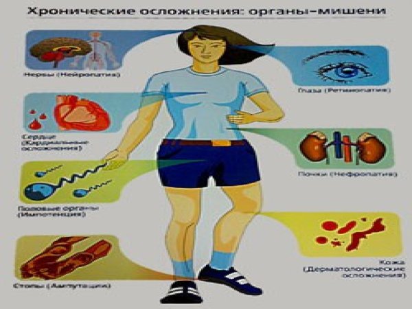 Санбюллетень сахарный диабет