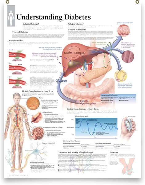 Памятка больному сахарным диабетом 2 типа