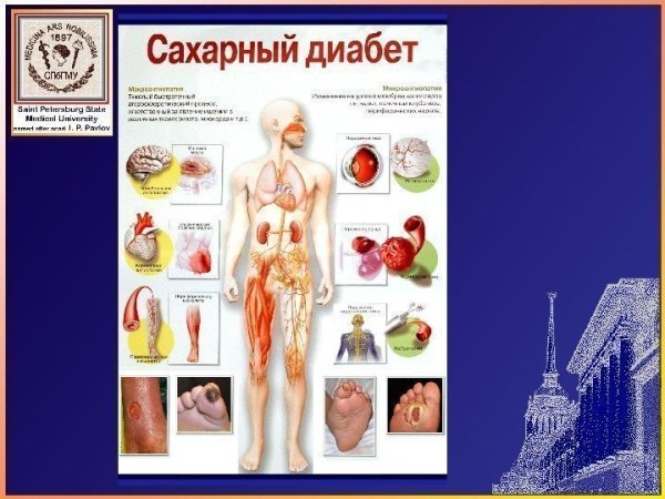 Профилактика осложнений сахарного диабета памятка