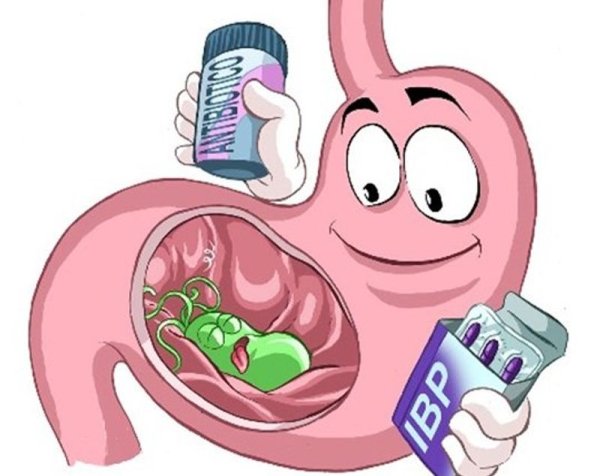 Гастрит хилокобактори пилори