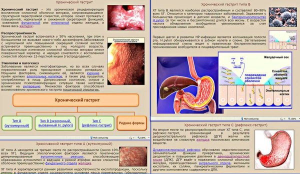 Памятка хронический гастрит