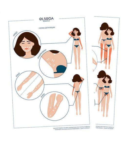 Схемы депиляции