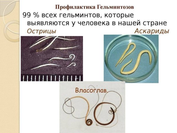 Гельминтозы презентаци
