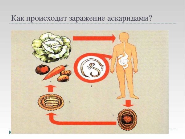 Признаки глистов у ребенка