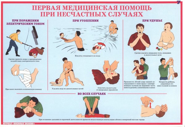 Методы и приемы оказания первой помощи