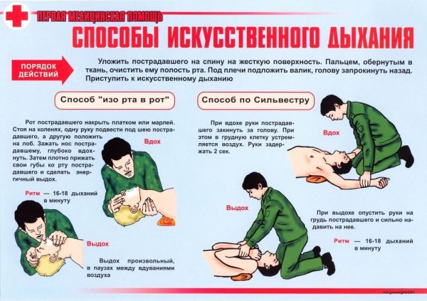 Основные способы выполнения искусственного дыхания