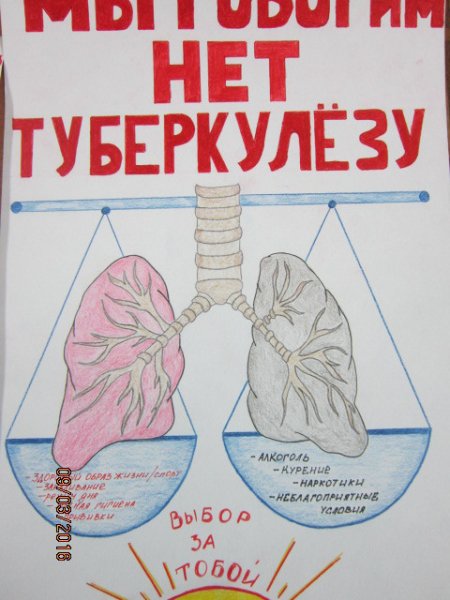 Санбюллетень профилактика туберкулеза
