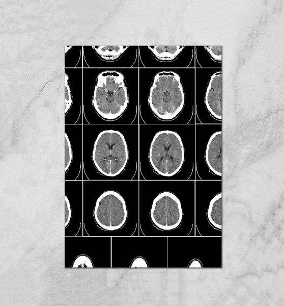 Компьютерная томография СССР