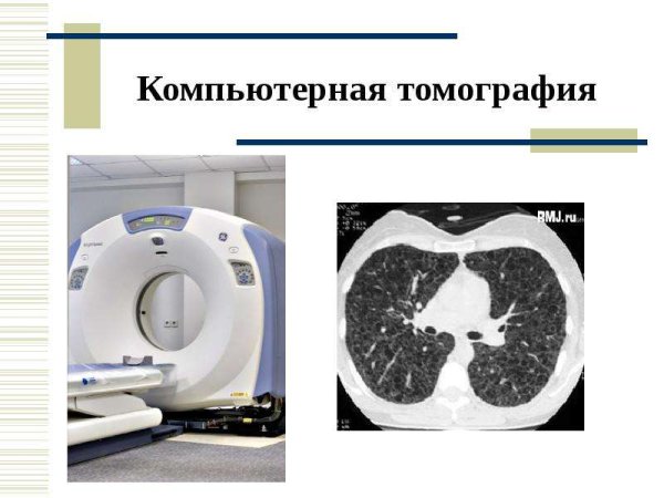 Презентацияякомпьютерная томография