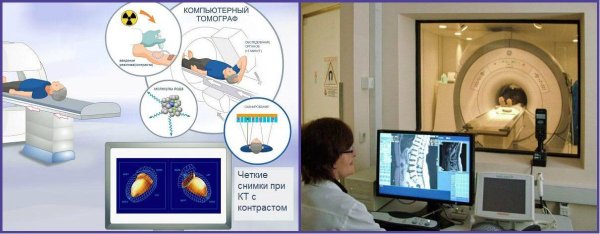 Рентгеновская компьютерная томография противопоказания