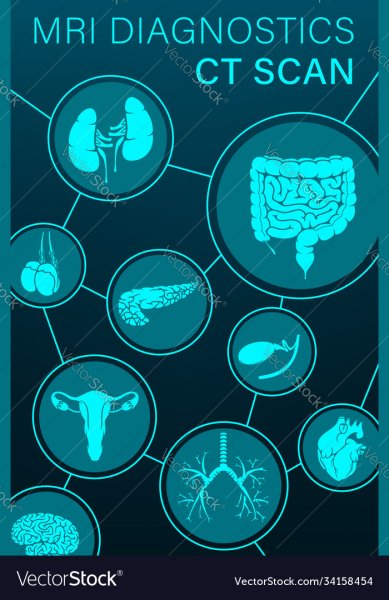 Диагноз мрт вектор