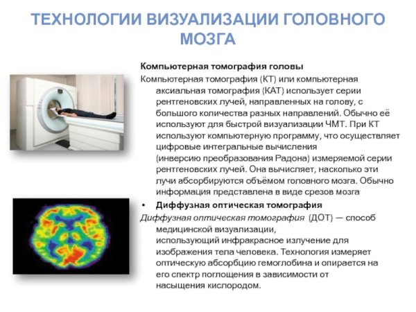 Компьютерной томографии кт принцип