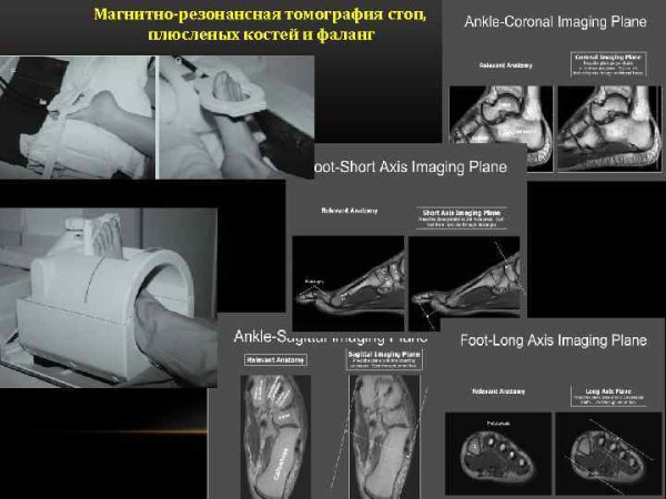 Кт как подготовиться к обследованию