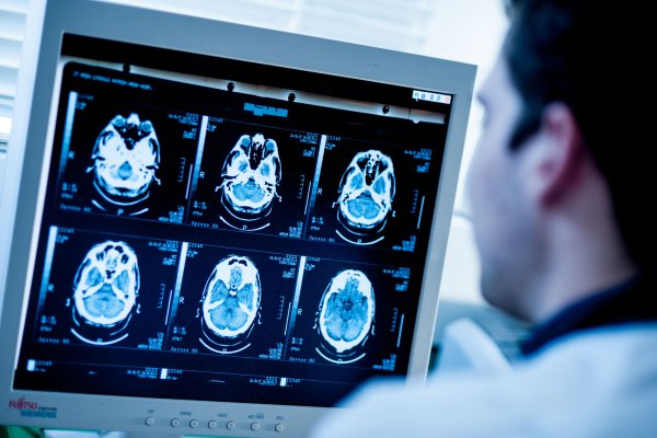 Рентгенологический способ лучевой диагностики