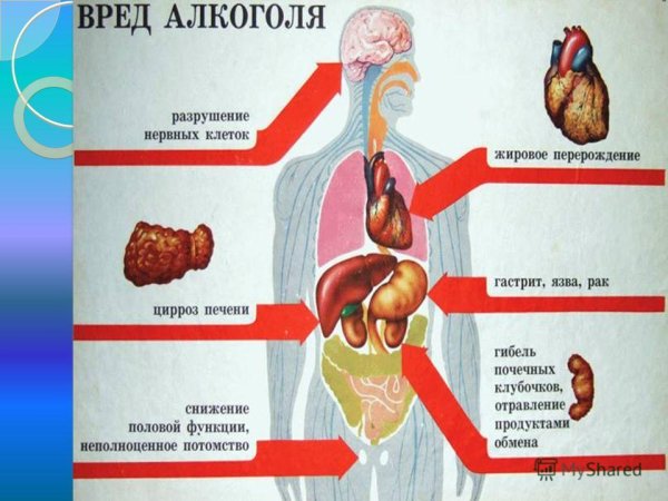 Вредные привычки алкоголь