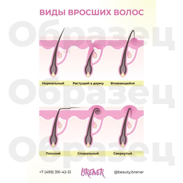 Плакаты для мастера депиляции